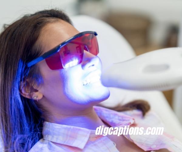 teeth-whitening-captions-for-instagram-with-quotes